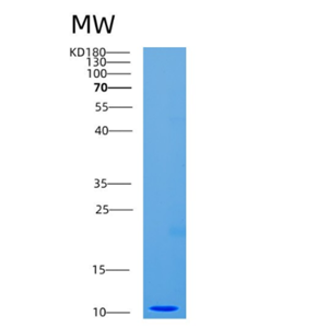 Recombinant Human CDC26 Protein