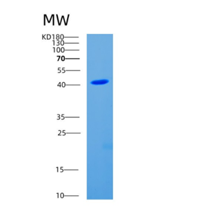 Recombinant Human CDC123 Protein