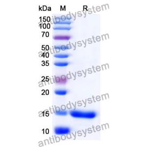 抗 Human CD152/CTLA4 納米抗體 (SAA0918)(RHD17202),Anti-Human CD152/CTLA4 Nanobody (SAA0918)