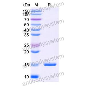 抗 SARS-CoV-2 S Protein 納米抗體 (SAA1082)(RVV00168),Anti-SARS-CoV-2 S Protein Nanobody (SAA1082)