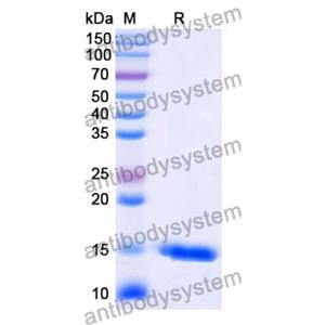 抗 Human CD38/ADPRC 1 納米抗體 (SAA1161)(RHD80801),Anti-Human CD38/ADPRC 1 Nanobody (SAA1161)