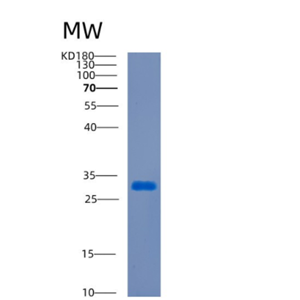 Recombinant Human CDCA8 Protein,Recombinant Human CDCA8 Protein