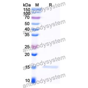 抗 Clostridium botulinum botA/BOTOX 纳米抗体 (SAA0931)(RXX00911),Anti-Clostridium botulinum botA/BOTOX Nanobody (SAA0931)