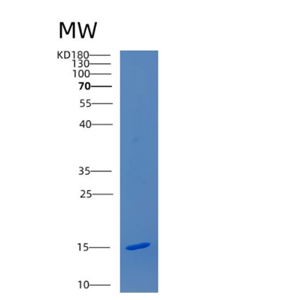 Recombinant Human CDKN2AIPNL Protein