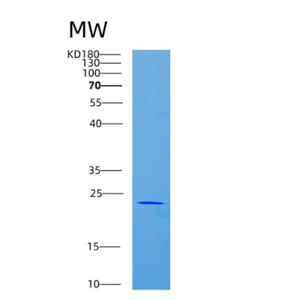 Recombinant Human CD84 Protein