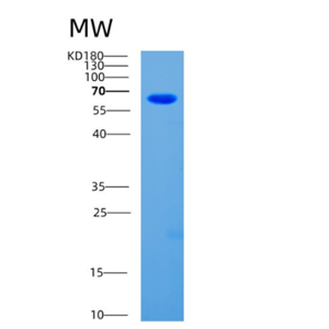 Recombinant Human CDC25A Protein,Recombinant Human CDC25A Protein