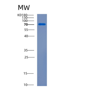 Recombinant Human CDCP1 Protein