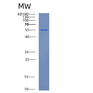 Recombinant Human CFLAR Protein,Recombinant Human CFLAR Protein