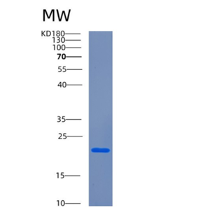 Recombinant Human CETN3 Protein,Recombinant Human CETN3 Protein