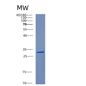 Recombinant Human CENPQ Protein