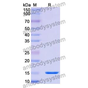 Anti-Human CD156c/ADAM10 Nanobody (SAA1217)