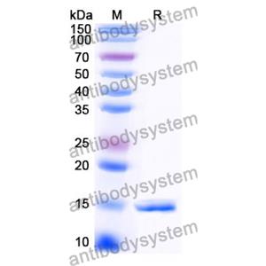 抗 Clostridium botulinum botA/BOTOX 纳米抗体 (SAA1350)(RXX00918),Anti-Clostridium botulinum botA/BOTOX Nanobody (SAA1350)