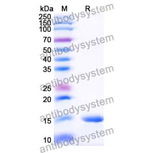 抗 Human PTCH1 納米抗體 (SAA1040)(RHG62203),Anti-Human PTCH1 Nanobody (SAA1040)