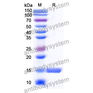 抗 Human RECQL5 納米抗體 (SAA1014)(RHB42603),Anti-Human RECQL5 Nanobody (SAA1014)