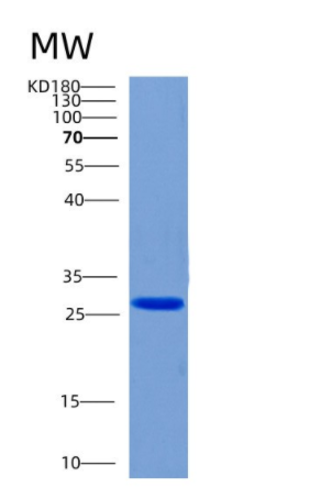 Recombinant Human CHMP6 Protein,Recombinant Human CHMP6 Protein