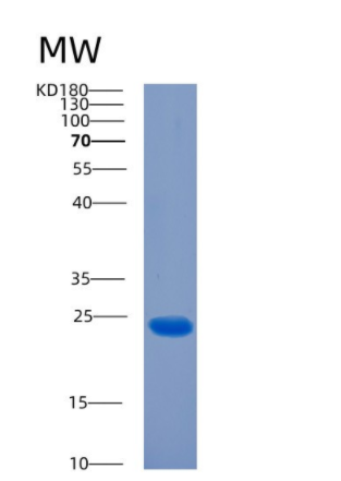 Recombinant Human CIB2 Protein,Recombinant Human CIB2 Protein