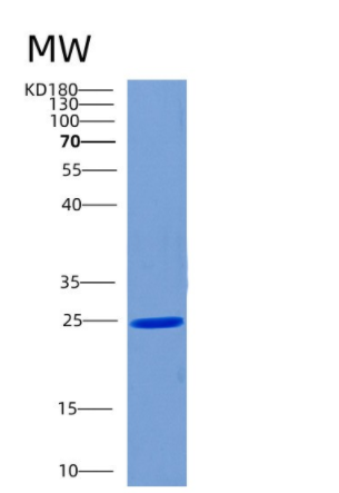 Recombinant Human CHMP1B Protein,Recombinant Human CHMP1B Protein