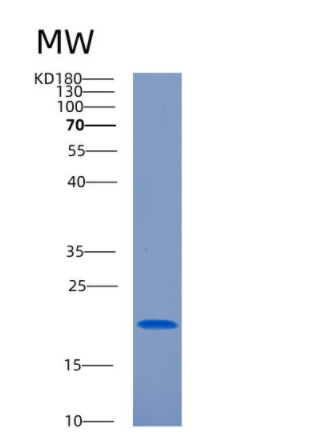 Recombinant Human CIRBP Protein,Recombinant Human CIRBP Protein