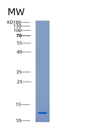 Recombinant Human CKS1B Protein,Recombinant Human CKS1B Protein