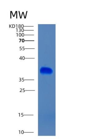 Recombinant Human CIAPIN1 Protein,Recombinant Human CIAPIN1 Protein