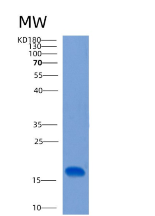 Recombinant Human CLEC2B Protein,Recombinant Human CLEC2B Protein