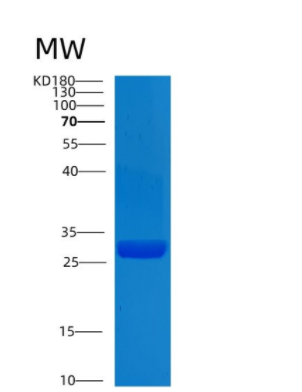 Recombinant Human CLIC1 Protein,Recombinant Human CLIC1 Protein