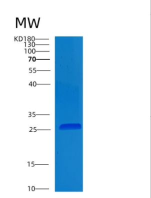 Recombinant Human CLMP Protein,Recombinant Human CLMP Protein