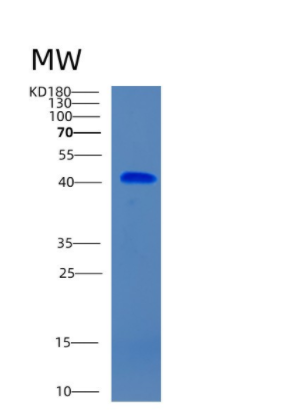 Recombinant Human CHST10 Protein,Recombinant Human CHST10 Protein