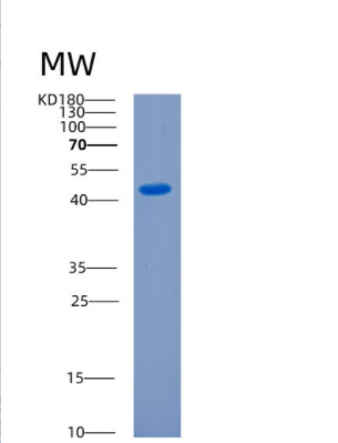 Recombinant Human CKMT1A Protein,Recombinant Human CKMT1A Protein