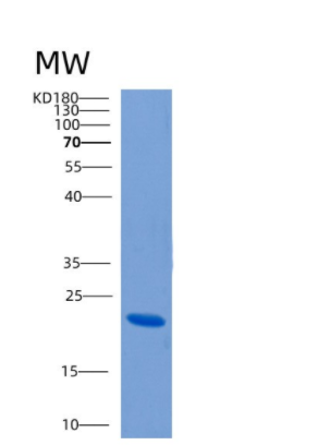 Recombinant Human CLEC4E Protein,Recombinant Human CLEC4E Protein