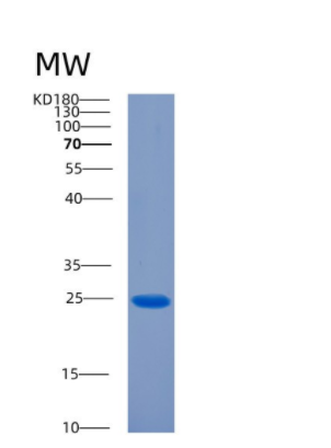 Recombinant Rat Ciliary neurotrophic factor Protein,Recombinant Rat Ciliary neurotrophic factor Protein