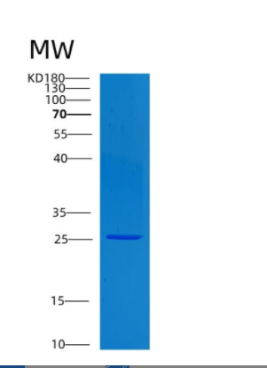 Recombinant Human CLTB Protein,Recombinant Human CLTB Protein