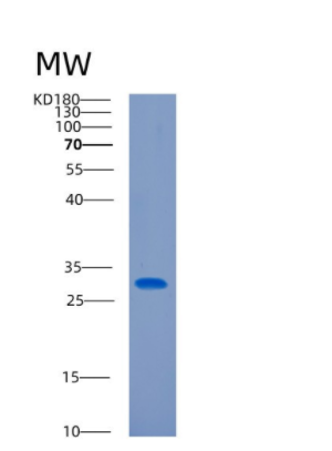 Recombinant Human CITED2 Protein,Recombinant Human CITED2 Protein