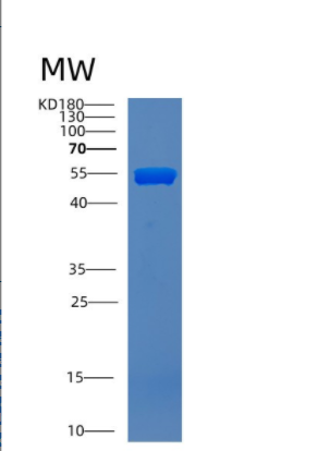 Recombinant Human CNDP1 Protein,Recombinant Human CNDP1 Protein