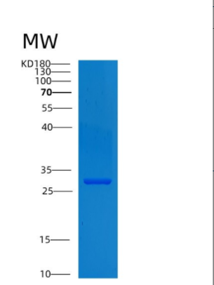 Recombinant Human CNPY4 Protein,Recombinant Human CNPY4 Protein