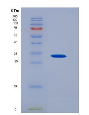 Recombinant Ciliary Neurotrophic Factor Receptor (CNTFR),Recombinant Ciliary Neurotrophic Factor Receptor (CNTFR)