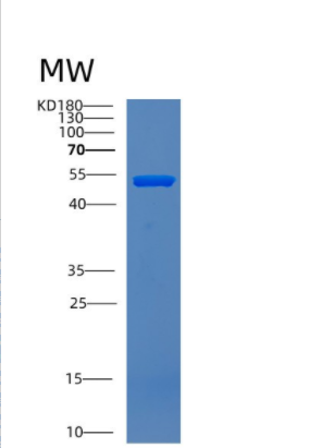 Recombinant Human CNDP2 Protein,Recombinant Human CNDP2 Protein