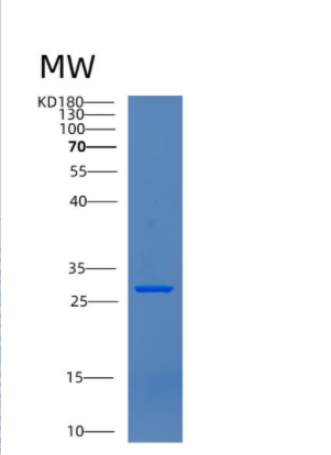 Recombinant Human CNPY3 Protein,Recombinant Human CNPY3 Protein