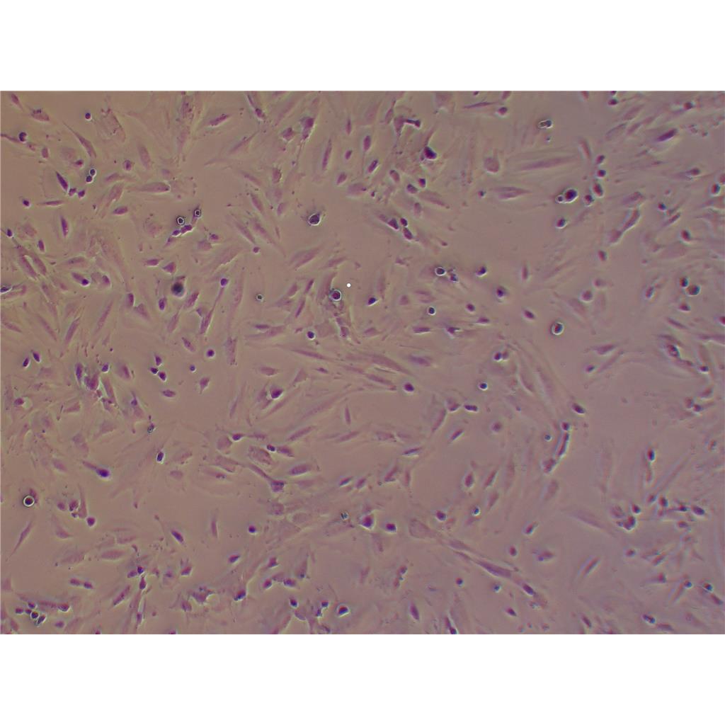 ihESCs永生化人子宫内膜异位基质细胞,ihESCs