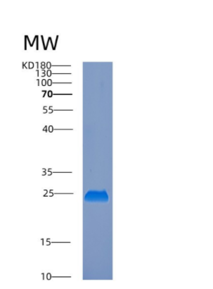 Recombinant Human COX4NB Protein,Recombinant Human COX4NB Protein