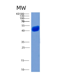 Recombinant Human CHI3L1 Protein,Recombinant Human CHI3L1 Protein
