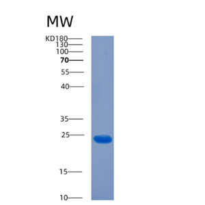 Recombinant Human CIB2 Protein,Recombinant Human CIB2 Protein