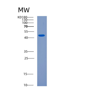 Recombinant Human CKMT2 Protein