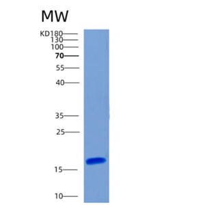 Recombinant Human CHRAC1 Protein