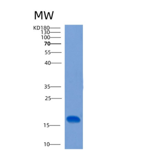 Recombinant Human CLEC2B Protein,Recombinant Human CLEC2B Protein