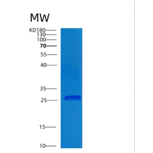 Recombinant Human CLMP Protein,Recombinant Human CLMP Protein