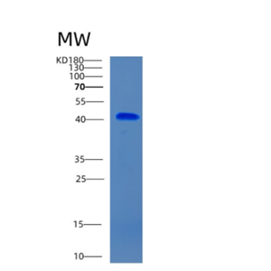 Recombinant Human CHST10 Protein,Recombinant Human CHST10 Protein