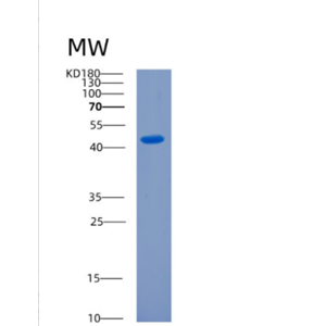 Recombinant Human CKMT1A Protein,Recombinant Human CKMT1A Protein