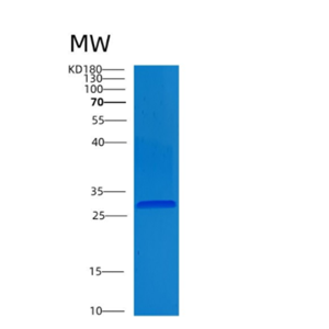 Recombinant Human CLIC4 Protein,Recombinant Human CLIC4 Protein