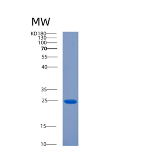 Recombinant Rat Ciliary neurotrophic factor Protein